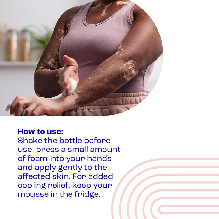 Itch Relief Coolmousse 100Ml – Face and Body Foam for Dry Skin, Itchy Skin and Irritated Skin - Cooling Foam to Soothe Itchy Skin