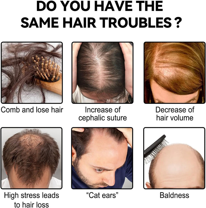 Tive/No Hair Concealer Cream,Tive/No Color Hair Concealer,Hair Concealer for Men & Women,Waterproof and Sweatproof Light Brown Hair Fillup Concealer,For Naturally Fuller and More Confident Hair