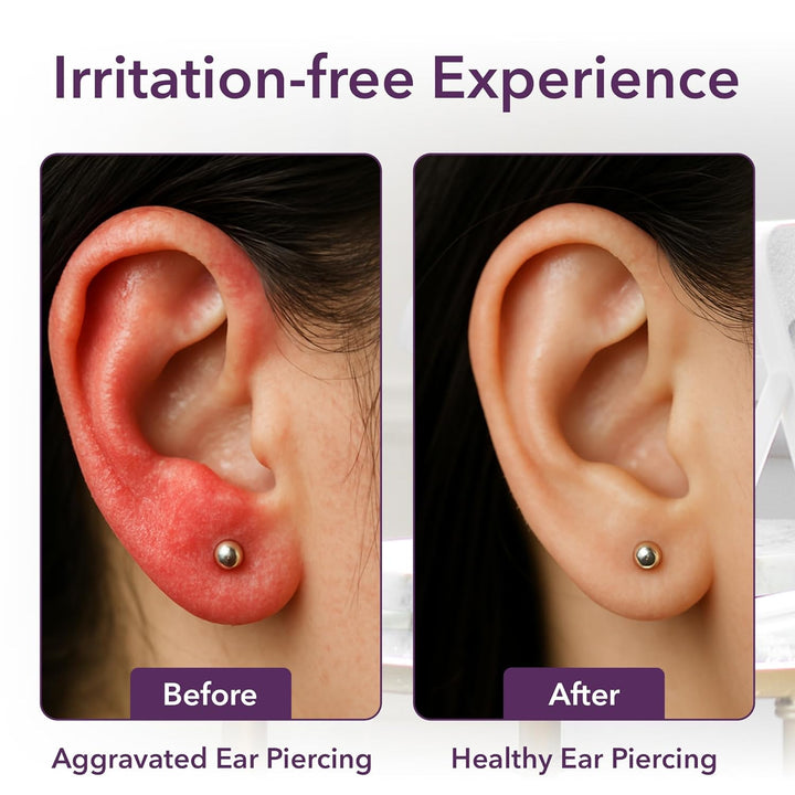 Sterile Saline Spray, Wound Cleansing & Piercing Aftercare Spray - 100Ml