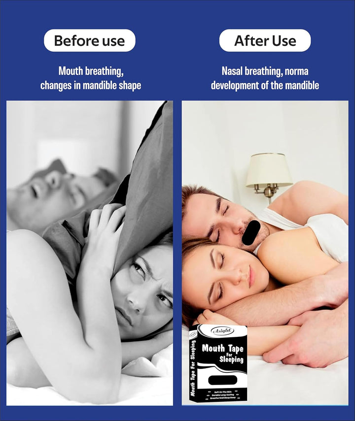 Mouth Tape| Snoring Aids for Women & Men| Mouth Tape for Sleeping | Sleep Aid to Improve Nasal Breathing| Sleep Tape| 30 Hypoallergenic anti Snoring Strips (Black)
