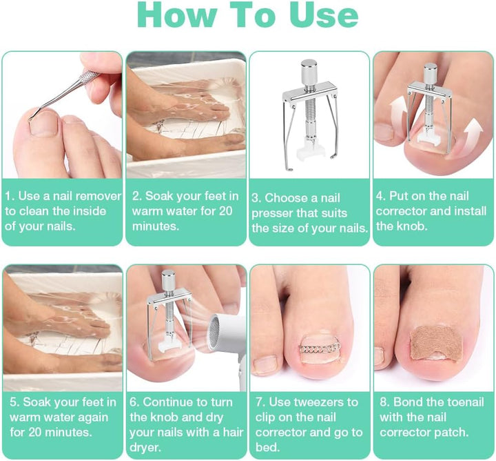 Ingrown Toenail Removal Kit, Ingrown Toenail-Corrector Tools with Podiatry-Toenail Braces, Silicone Toe Strap, Toenail Straightener Strips and Patch for Toe Pain Relief