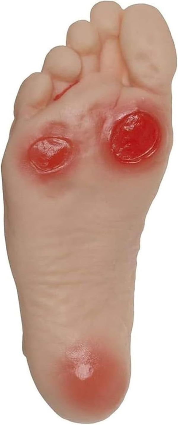 Diabetic Foot Model, Geriatric Nursing Model - Contains 3 Ulcers, for Patient Education and Student Training