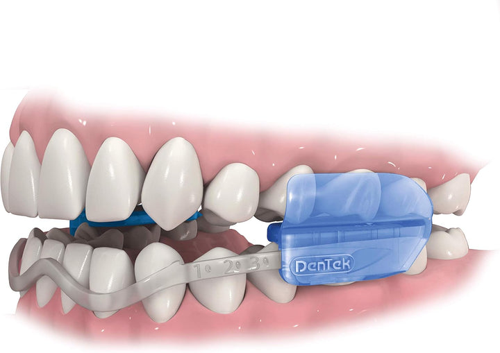 Comfort-Fit Dental Mouth Guards to Help Prevent Night Time Teeth Grinding and Clenching Known as Bruxism (2 Pack)