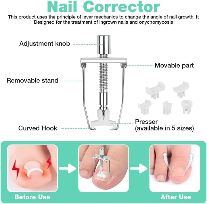 Ingrown Toenail Removal Kit, Ingrown Toenail-Corrector Tools with Podiatry-Toenail Braces, Silicone Toe Strap, Toenail Straightener Strips and Patch for Toe Pain Relief