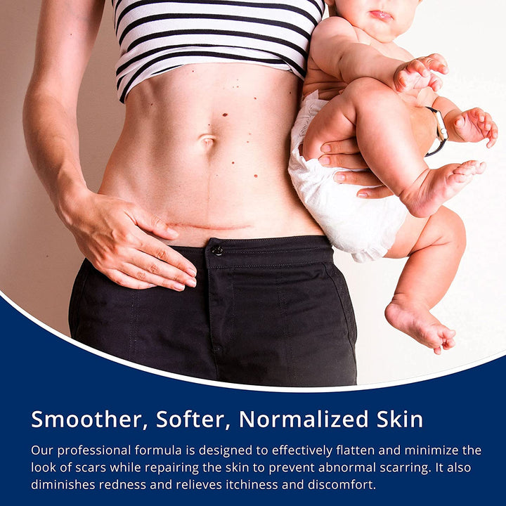 Silicone Scar Gel 30G Scar Cream,Scar Removal,Scar Treatment, Scar Removal Cream for C-Section, Stretch Marks, Acne, Surgery, Effective for Both Old and New Scars