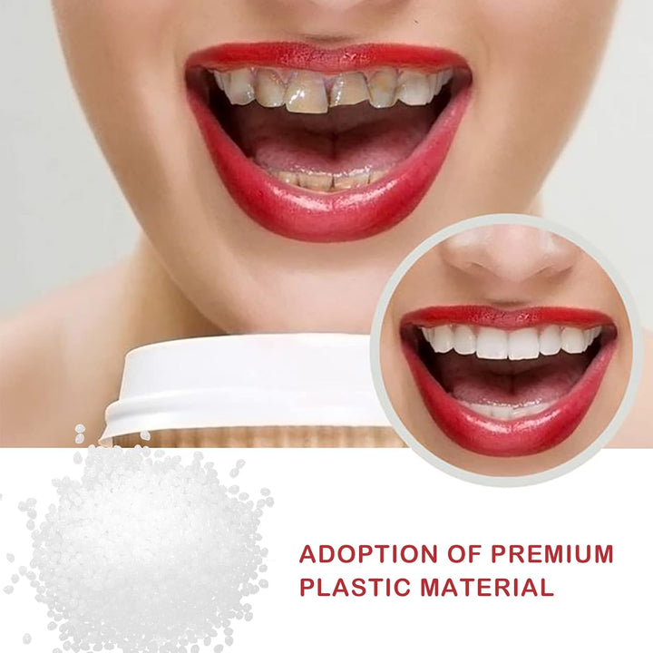 60G Tooth Repair Beads - Thermal Adhesive Fitting Beads Dental Tooth Filler Kit for Fixing Missing and Broken Teeth