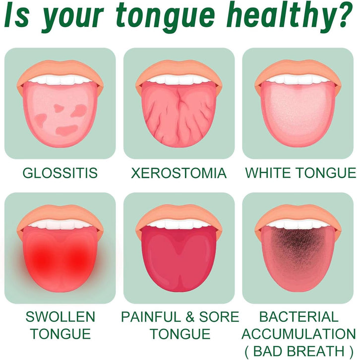 Tongue Repair Spray,Moisturizing Dry Mouth Spray,Fissured Tongue Relief Spray,Instant Dry Mouth Relief,Breath Freshener Spray for Tongue Relief,Tongue Relief Treatment,For White Coating/Bad Breath