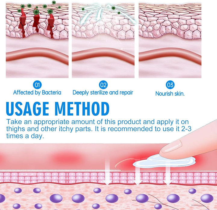 Anti-Fungal Cream for Men and Women,Cream for Private Parts,Anti/Fungal anti Ttch Cream,Quickly Relieve Itching,Anti-Fungal Cream for Quick Itching,External Cream for Men and Women,Anti/Fungal Cream