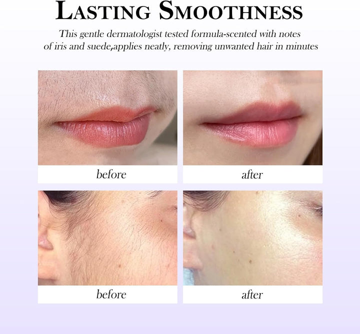 Facial Hair Removal Cream for Women, Ladies Body and Face Hair Remover Cream for Sensitive Skin, Upper Lip, Chin & Cheeks + Calming Serum, 8-Minute Fast Acting Gentle Painless Depilatory Creams Kit
