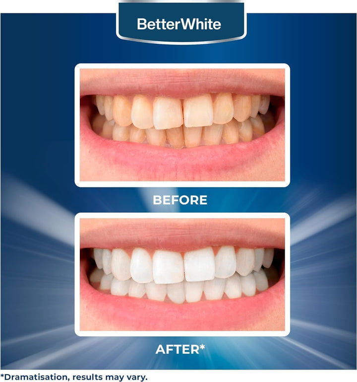 Professional Teeth Whitening Strips 7 Treatments - Enamel Safe - Non-Sensitive Formula - 14 Peroxide-Free Whitening Strips - Dentist Formulated Teeth Whitening Kit