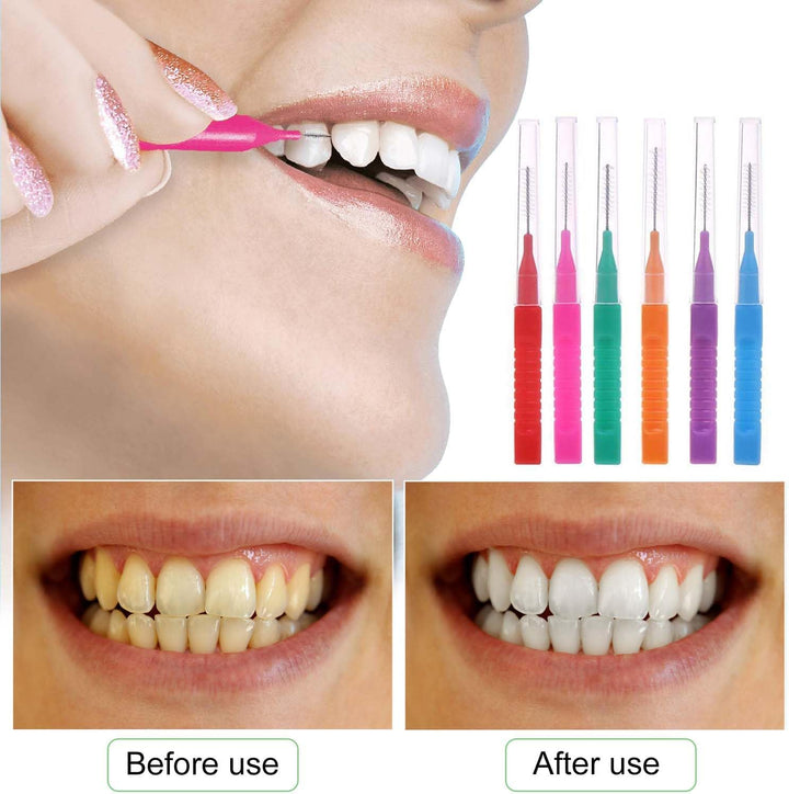 48 Pcs Interdental Brushes, Tooth Cleaning Tool for Cleaning Gaps between Teeth(6 Colors)