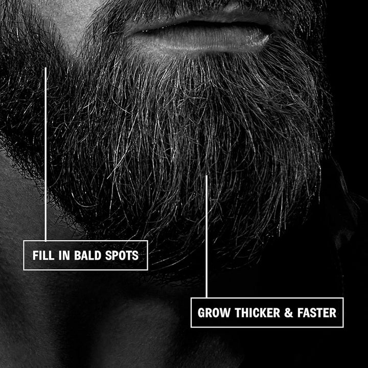 Beard Roller 0.5Mm – 540 Titanium Microneedle Derma Roller for Beard Growth & Hair Regrowth for Men – Microneedling Tool for Thicker, Fuller Beard & Skincare