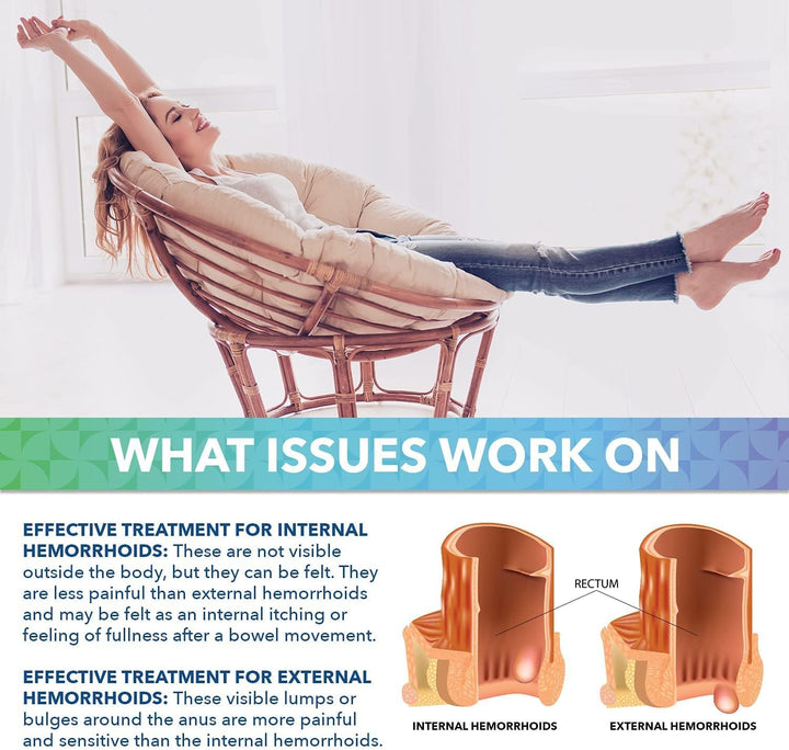 Hemorrhoids Treatment Hemorrhoid & Fissure Cream Fast Acting Hemorrhoid Cream and Healing Formula for Itching Swelling Bleeding Burning and Maximum Pain Relief 30G,1Pack