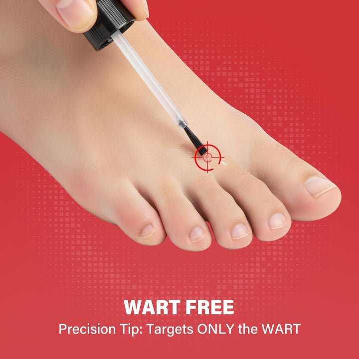 Fast Acting Wart Remover, Verruca Remover, Gentle Removal of Common Warts, Plantar Warts, Corn and Calluse, Suitable for Hands and Feet, Trusted by the Whole Family