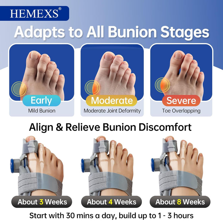 Bunion Corrector Big Toe Straightener for Women & Men – Adjustable Splint for Hallux Valgus, Bunion Relief & Pain Alignment – Day & Night Wear (Left/Right Foot)