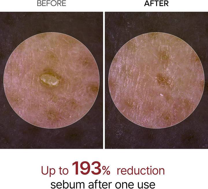 Peel Shot Glow Black Rice Peeling Ampoule Soft Exfoliating Face and Body Scrub Dead Skin Cells Blackheads Remover for All Skin Types Korean Skin Care 80Ml