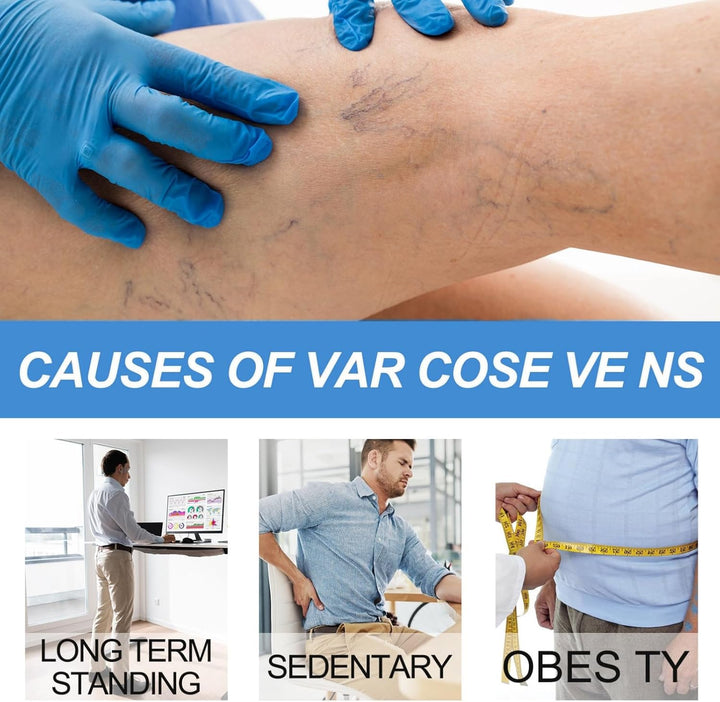 Varicos/E Ve/Ins Treatment for Legs,Varic/Ose Ve/Ins Treatment Cream,Sp/Ider Ve/Ins Repair Cream,Varicos/E Vein/S Cream,Spi/Der Vei/N Removal,Cre/Am for Varic/Ose V/Eins,Safe Formula,Portable