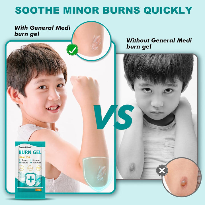 Burn Gel - 25 Packs First Aid Burns Care Scalds Sunburn Dressings Cooling Gel