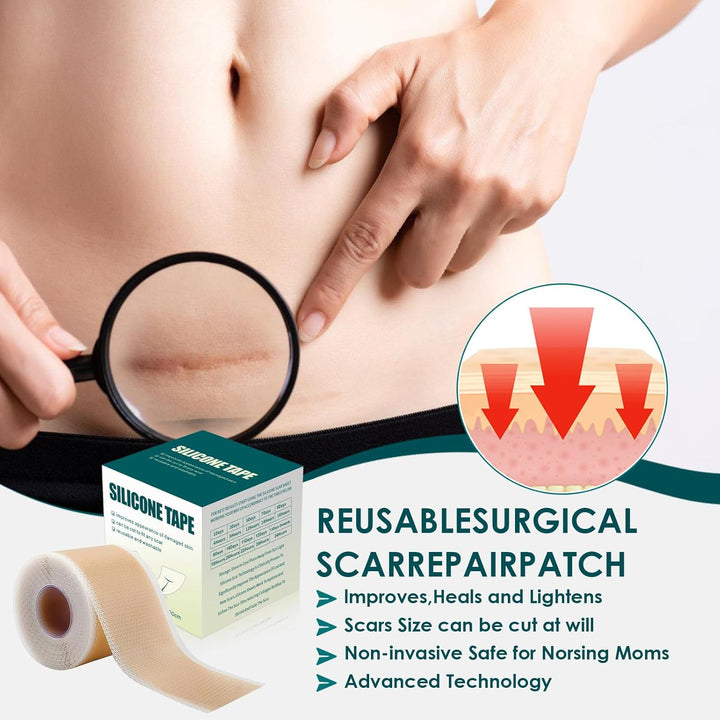 Silicone Scar Sheets, Premium Silicone Gel Scar Tape, Reusable Silicone Patches, Painless Silicone Tape Roll, Silicone Scar Tape for Surgeries Scars, C-Sections, 1.6'' X 120''Roll-3M