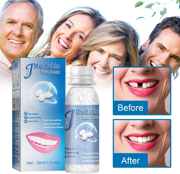 Temporary Tooth Filling,Repair Beads Tooth Filling Repair Kit,False Teeth,Moldable Tooth Repair Kit,Thermal Forming Filling Kit for Teeth,Tooth Repair Granules,Diy Fixing Dental Bridge Repair Kit