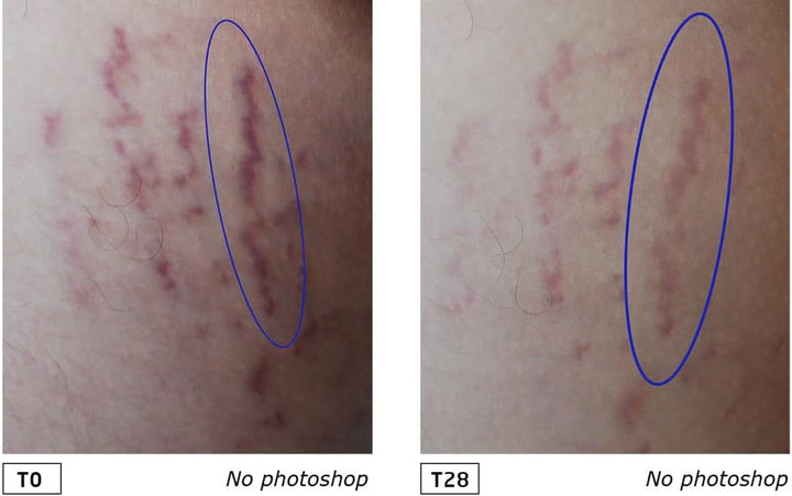 Organic Mama Pregnancy Body Butter - Rich Natural Cosmetics Massage Body Butter to Prevent Stretch Marks on the Stomach, Thigh and Chest (1 X 150 Ml)