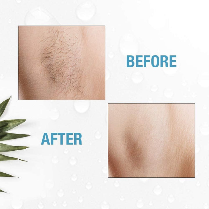 Clean & Easy Deluxe Home Electrolysis Permanent Hair Removal Kit