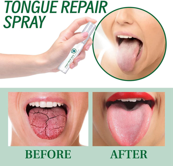 2Pcs Tongue Repair Spray,Sore Tongue Relief,Breath Fresheners,Fissured Tongu/E Relief Spray,Tongu/E Moisturizing S/Pray,Instant Dry Mouth R/Elief,Mou/Th Spra/Y for Dryness