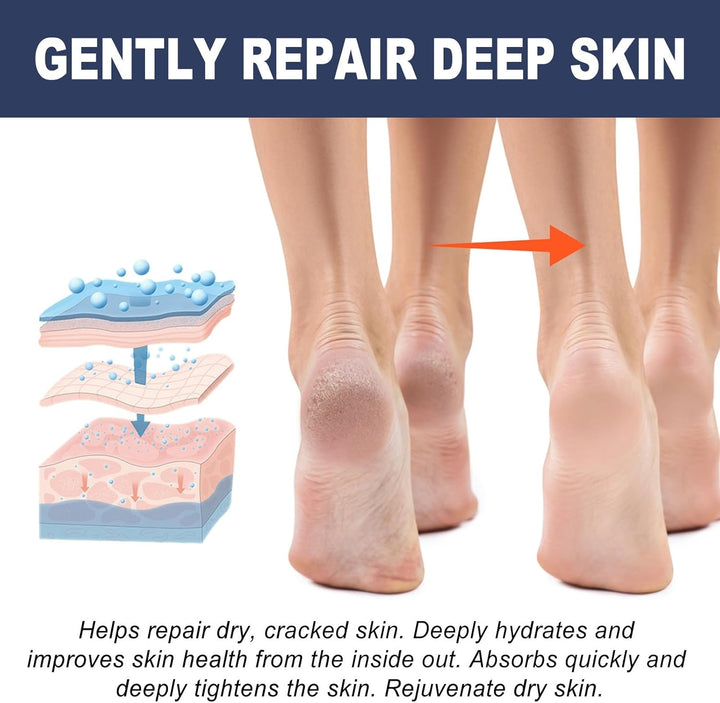 2PCS Athletes Foot Treatment,Anti Fungal Skin Cream,Antifungal Cream for Effective Anti-Itch,Itch Relief Cream,Foot Fungus Treatment,Itchy Skin Relief for Adults,Athletes Foot Cream Extra Strong