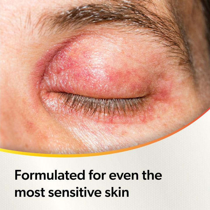 Protect Antibacterial Cleansing Eye Spray – for Daily Protection against Bacteria Overgrowth on Eyelids and Surrounding Skin - Preservative Free - 250 Applications