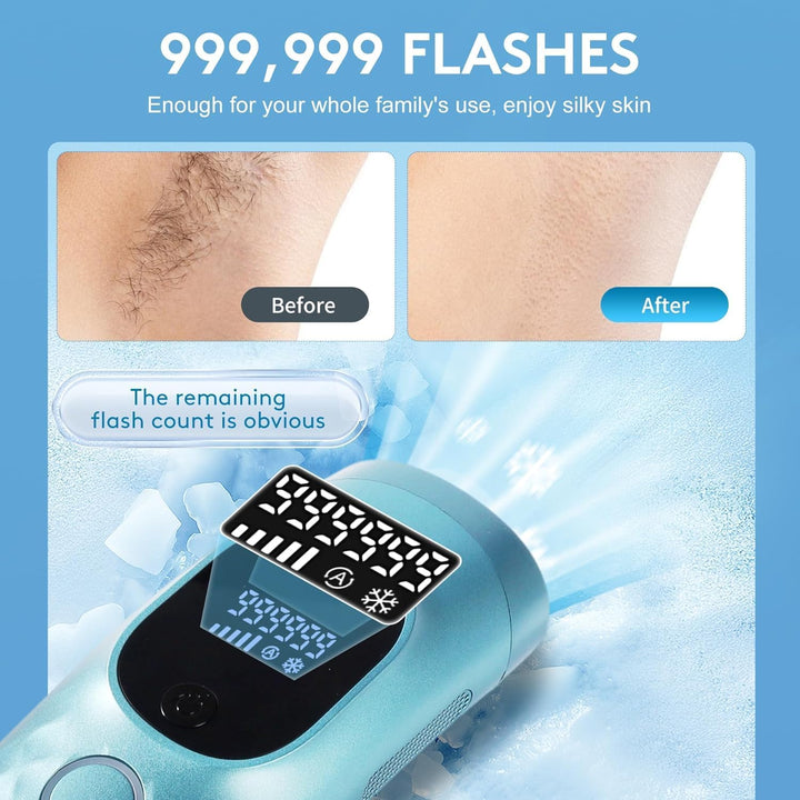 IPL Hair Removal Device, Laser Hair Removal Device 3-In-1,5 Energy Levels, 999,999 Flashes, 2 Control Modes, IPL Laser Hair Remover for Women Body Facial Bikini Line Arm Leg, Home Use (Sky Blue)