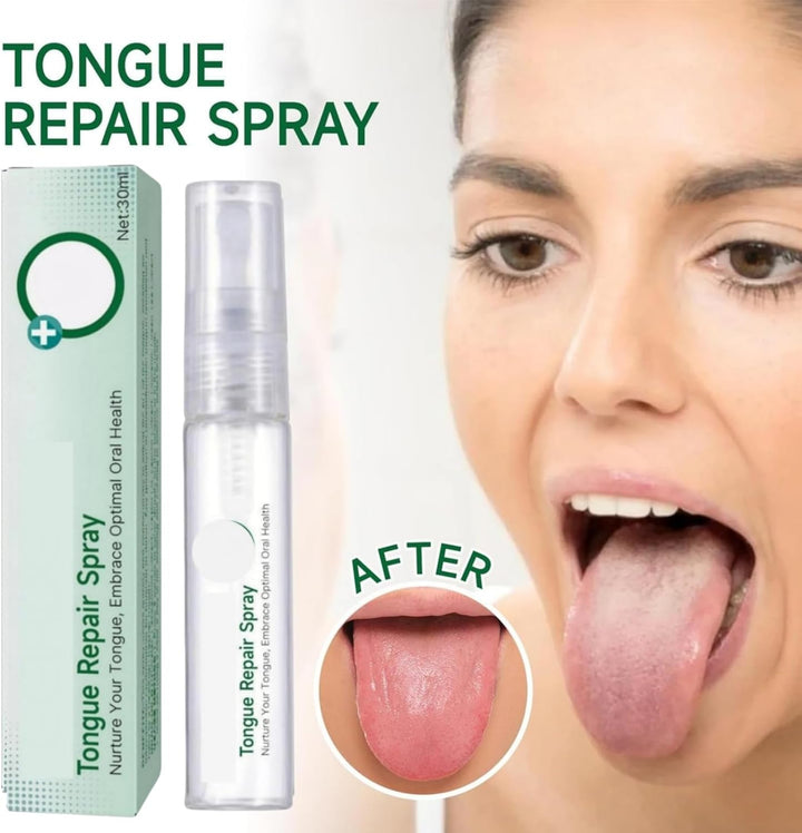 Tongue Repair Spray,So/Re Tongue Relief,Breath Freshener Spray,So/Re Mouth and Ton-Gue Treatment,Remove White Dirt,Instant Dry Mouth Relief,Moisturizing,Natural Ingredients,Mild and Non-Irritating