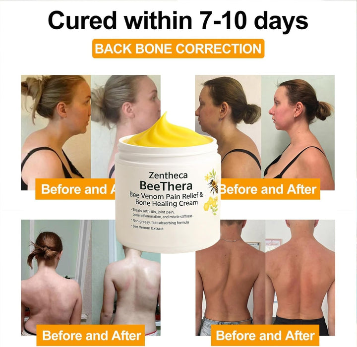 Zentheca Beethera Bee Pain Relief & Bone Healing Cream, Bee Cream for Arthritis-Infused Relief for Bones & Joints, Advanced Joint and B-One Cre-Am for Back, Neck, Hands, Knee (1)