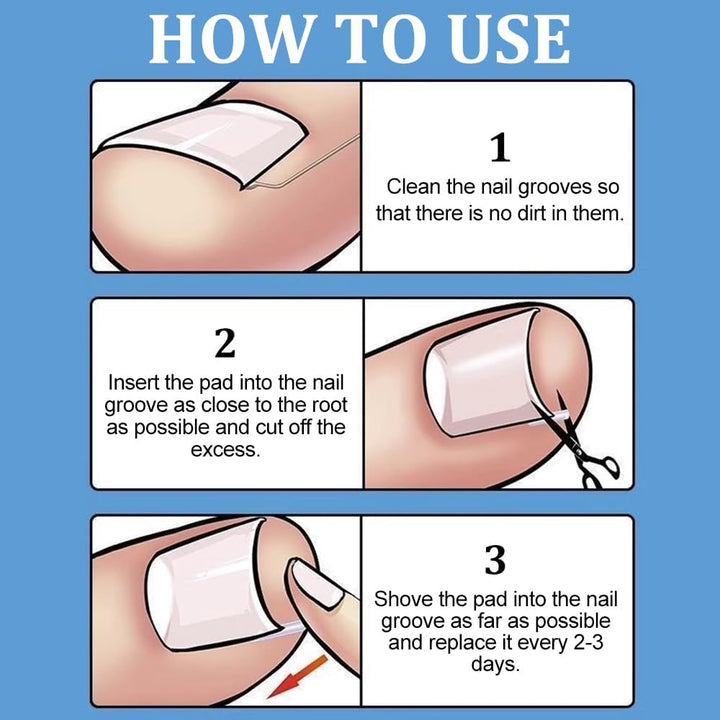 Ingrown Toenail Corrector Set - 50 PCS Pain-Free Toenail Straightener Strips with Toenail Lifter - Easy Use Ingrown Toenail Tools Kit