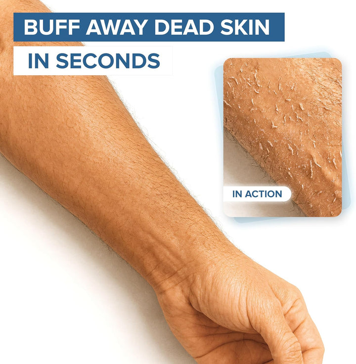 DEEP Exfoliation Body Exfoliator Mitt for Dead Skin Removal (1 Glove)  Exfolimitt Exfoliating Glove for Smooth, Healthy & Glowing Skin - Washable, Quick-Drying & Gentle on Skin