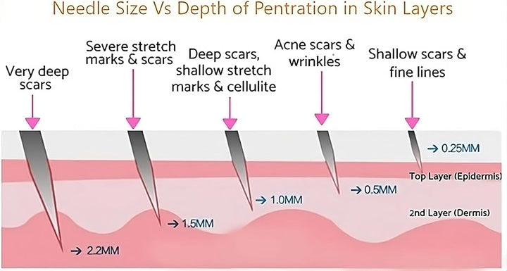 Derma Roller Hair Growth Men and Women, 540 Titanium Micro Needling Roller for Hair Growth, Beard Roller for Skin Care and Beard Growth,Universal with Carry Case (Derma 0.5Mm)