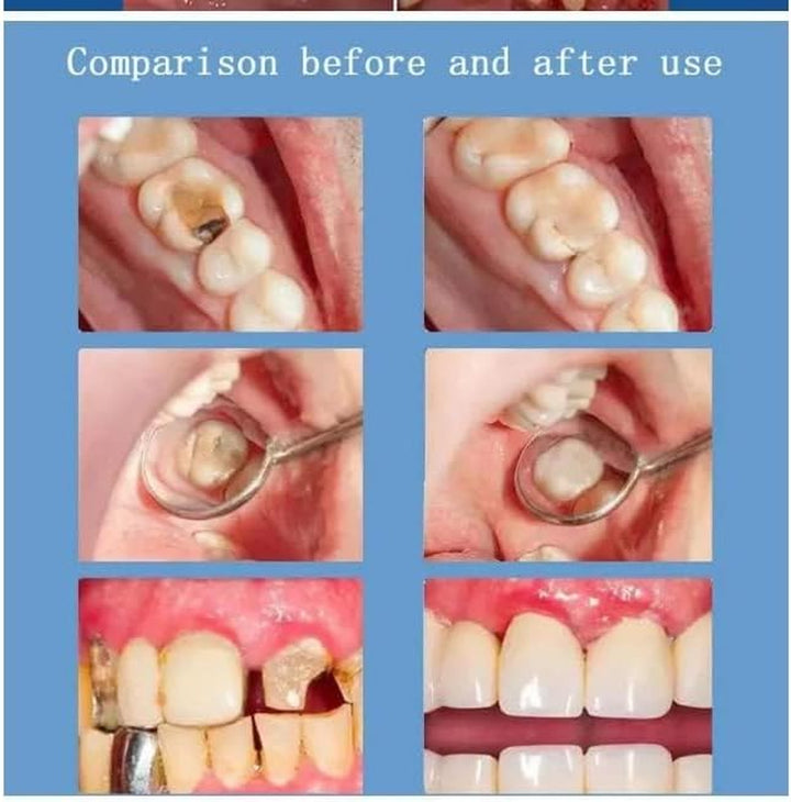 Probiotic Toothpaste, Probiotic Whitening Toothpaste, Protects Tooth Enamel, Freshens Breath, Fluoride-Free Formula, Removes Stains, Suitable for Adults and Children