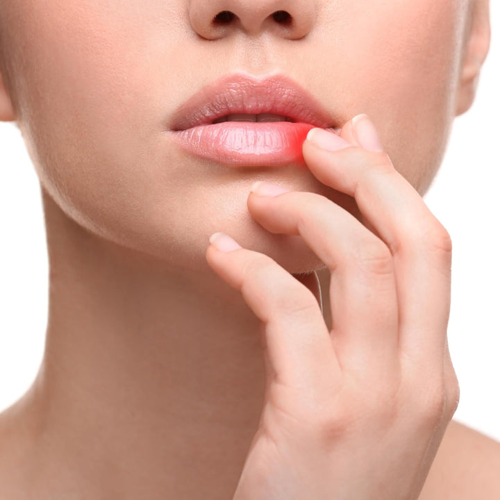 3 X 2G 5% Cold Sore Relief Cream (3 Packs) - Effective Treatment - TDY Bundle Including Cold Sore Care & Prevention Guide