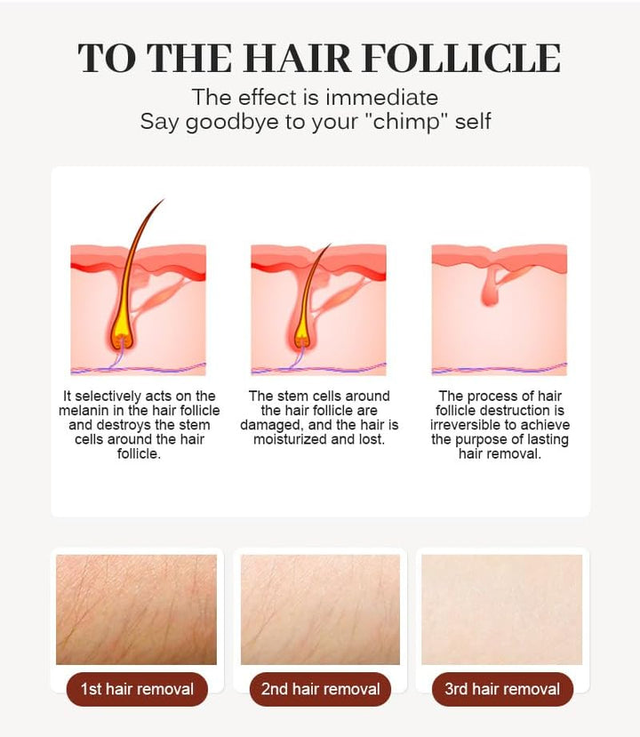 2025 New 808 Diode Laser Hair Removal Machine Triple Wavelength Painless Permanent Portable 808Nm 755Nm 1064Nm