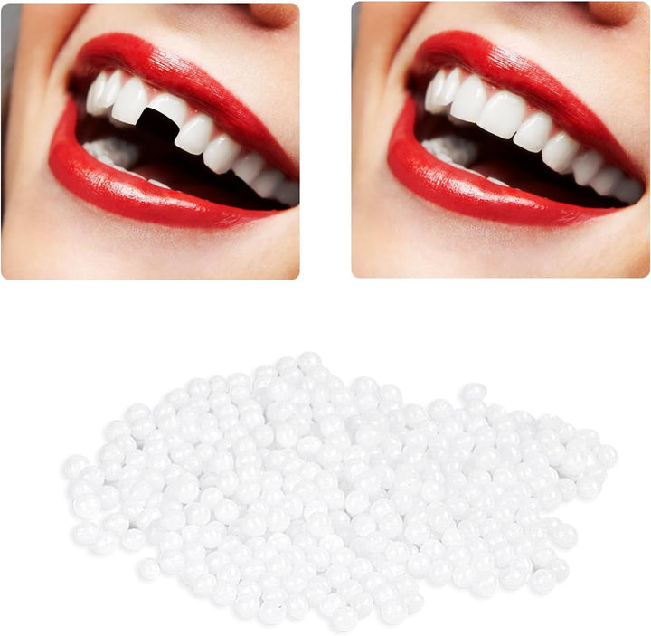 Temporary Tooth Repair Kit, 50G Temporary Tooth Filling Repair Thermal Beads Teeth Fixing Tooth Beads, Dental Tooth Filling Material for Fixing Filling Missing Broken Tooth