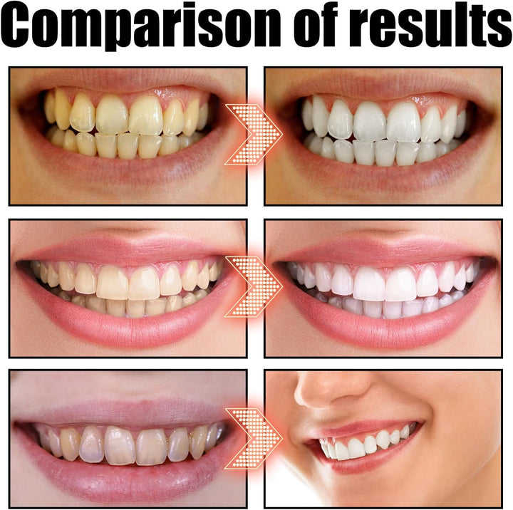 Whitening Mouthwash - Coconut Mint Extraction Oil for Stains and Gum Health | See before and after Results | Alcohol-Free Set with Tongue Scraper (100Ml)