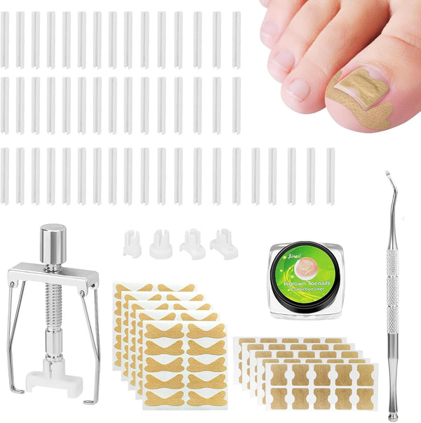 100Pcs Ingrown Toenail Corrector,Toenail Brace,Ingrown Toenail Corrector Treatment Set,Ingrown Toenail Tool,Suitable for Foot Care,With 50 Card Slots,1 Nail Clipping Box and 1 Corrector