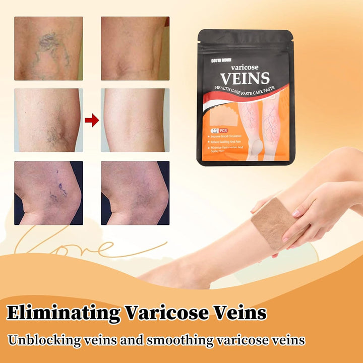 12Pcs Spider Veins Removal for Legs Treatment Patch, Varicose Veins Treatment for Legs, Varicose Veins Patch Relief Leg Pain Strengthen Capillary Health & Improve Blood Circulation