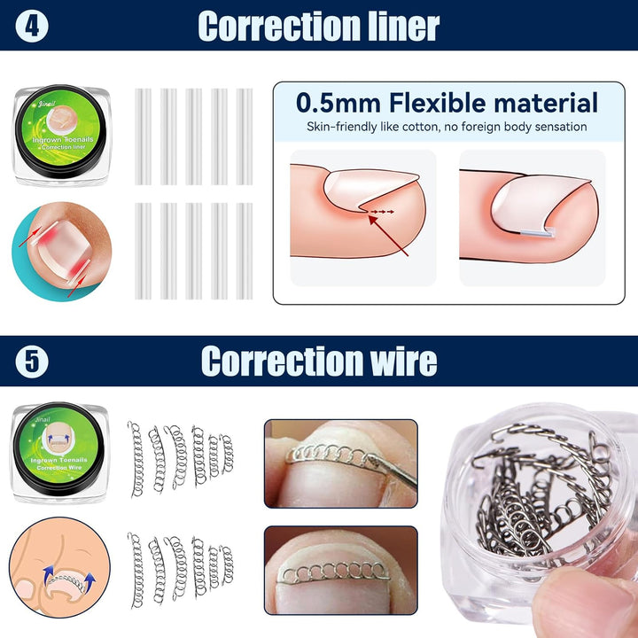 Ingrown Toenail Removal Kit Ingrown Toenail Treatment Tool Kit Ingrown Toenail Corrector Tools with Toenail Braces, Podiatry Tools, Ingrown Toenail Corrector Strips and Patch for Toe Pain Relief