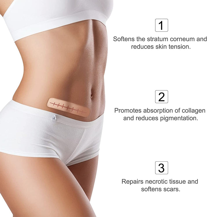 Silicone Scar Sheets, Silicone Scar Tape (1.6” X 120”Roll-3M), Scar Tape Roll Medical Silicone Easy-Tear Gel Tape Roll, Scar Removal Sheets Works on Old & New Scars, Scar Treatment Sheets