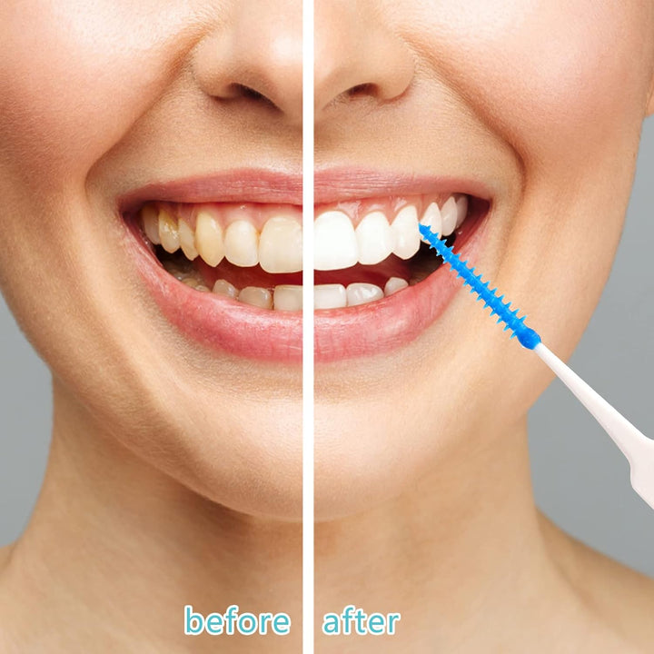 220 Pieces Interdental Brushes, Silicone Dental Brushes Blue Tooth Floss Picks for Braces Oral Cleaning