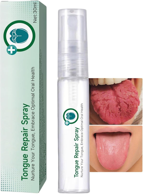 Tongue Repair Spray, Oral Antibacterial Spray, Instant Dry Mouth Relief, Fissured Tongue-Relief Sprays, Mint Breath Freshener Sprays, Tongue Repair-Spray for Dryness, White Coating and Bad Breath