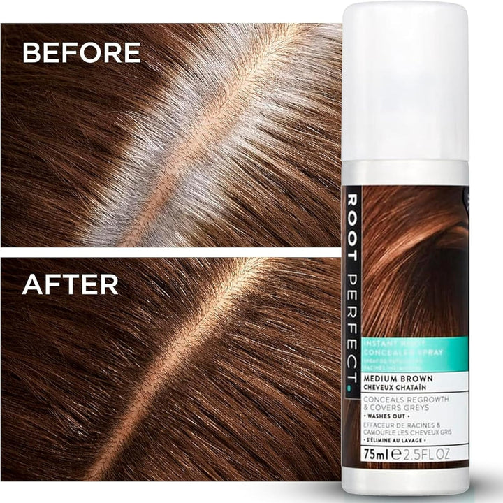 Root Touch up Spray – Dark Brown, Instant Root Concealer for Grey Coverage, Temporary Hair Colour Spray, Quick-Dry, Hair Disguise Solution, 75Ml