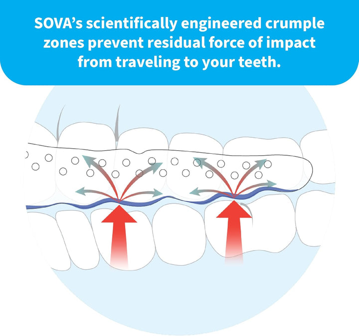 Aero 1.6Mm Night Guard Custom-Fit Dental Mouth Guard, Mouth Guard with Case, White, (SVA-CASE-W)