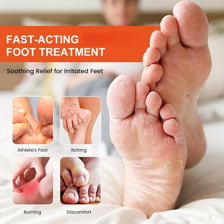 2PCS Athletes Foot Treatment,Anti Fungal Skin Cream,Antifungal Cream for Effective Anti-Itch,Itch Relief Cream,Foot Fungus Treatment,Itchy Skin Relief for Adults,Athletes Foot Cream Extra Strong