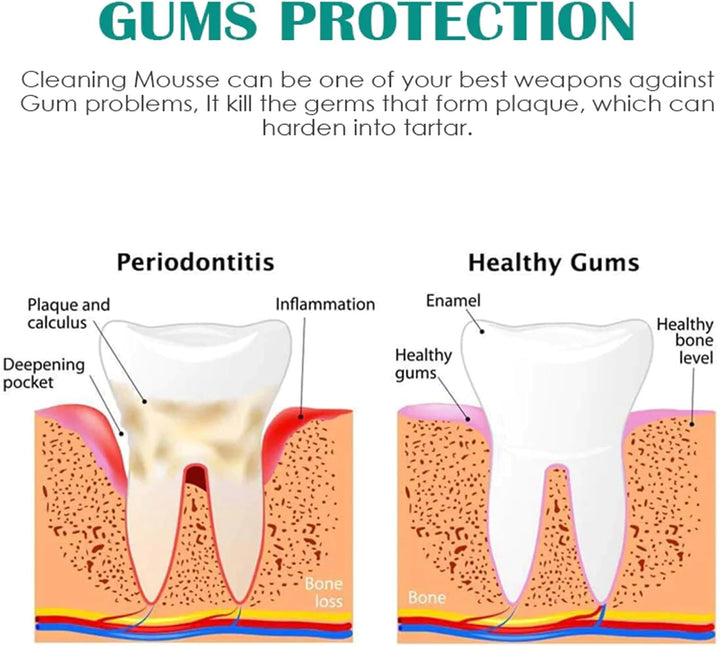 Professional Tooth Paint and Whitening Pen with Strips - Instant Teeth Whitening Essence and Enamel
